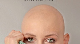 ALOPECJANKI - historie łysych kobiet Książka, LIFESTYLE - 14 października nakładem Wydawnictwa Harde ukaże się reportaż ?Alopecjanki. Historie łysych kobiet? pióra Marty Kawczyńskiej. Są to poruszające historie dziesięciu kobiet mających alopecję, którym ?łysa głowa? nie przysłoniła życia.